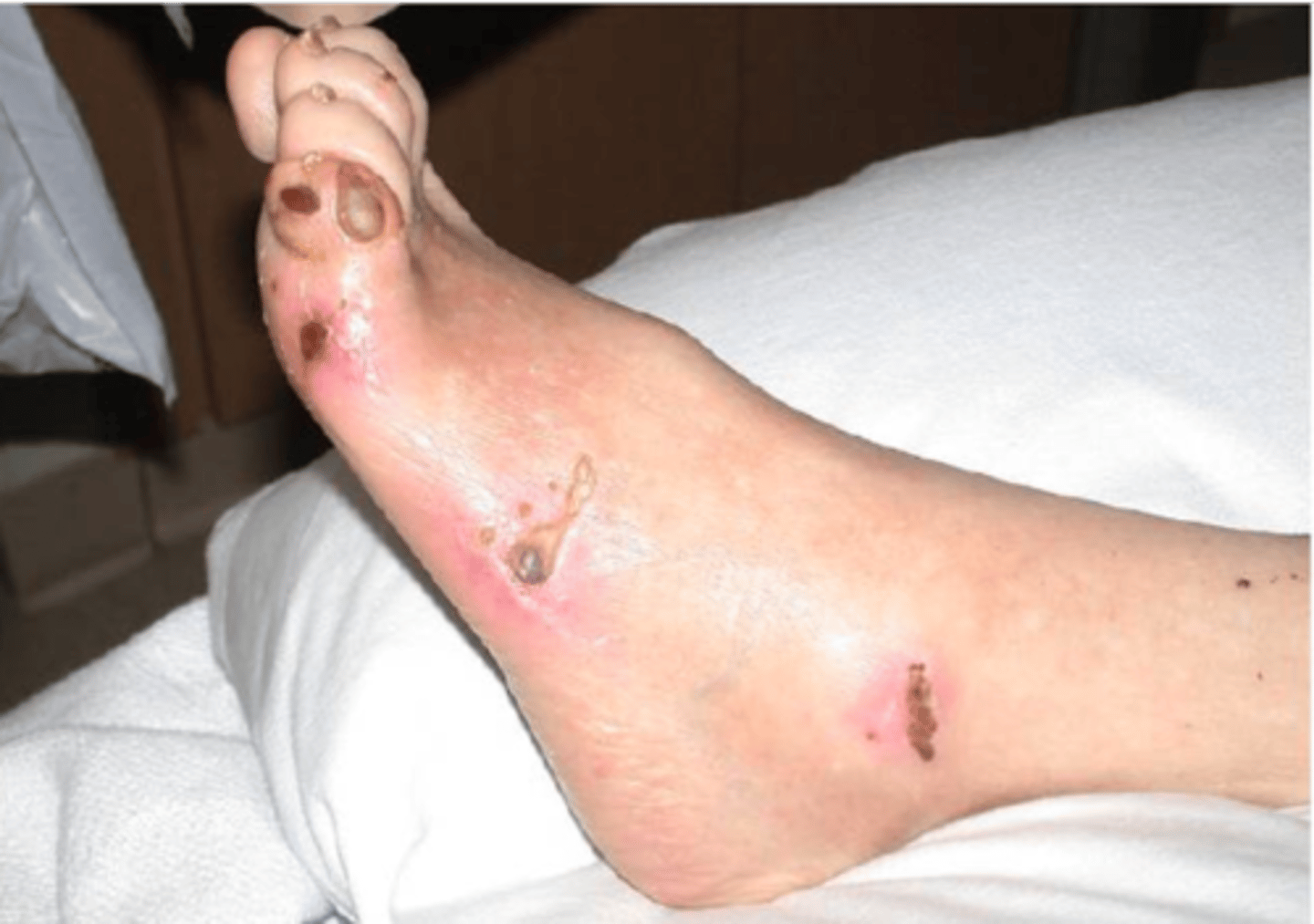 <p>A1C</p><p>BP</p><p>Cholesterol</p><p>Diet/Obesity</p><p>Exercise</p><p>Smoking</p>