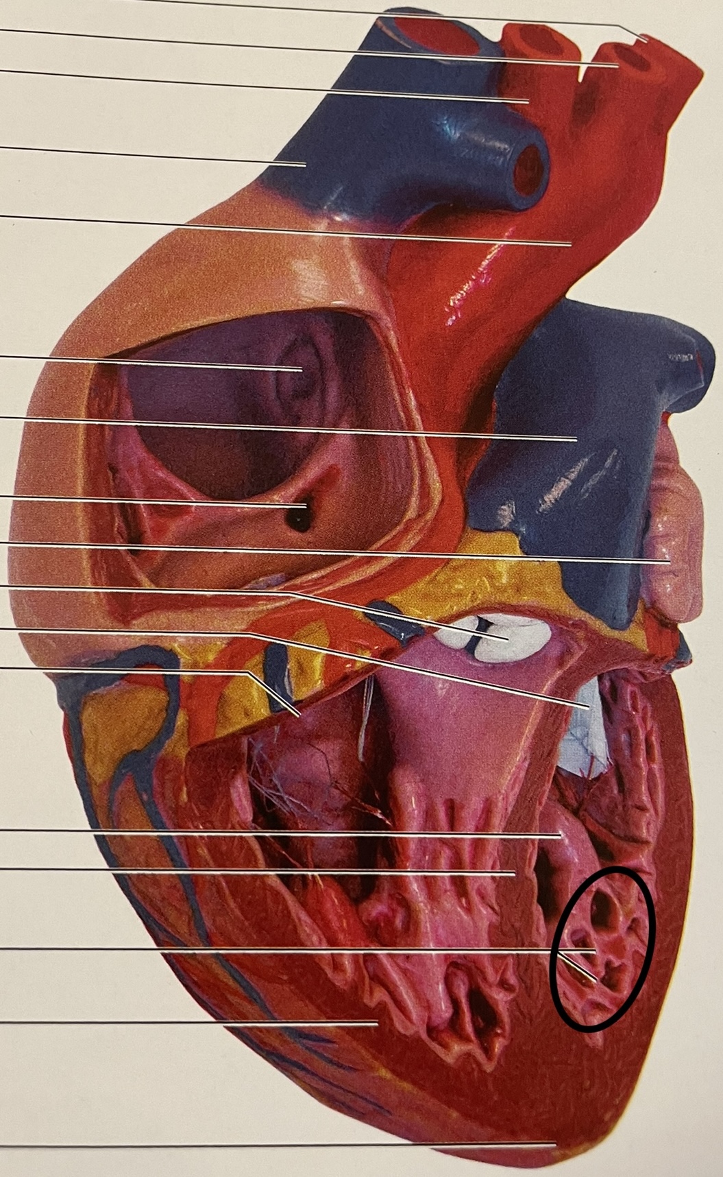 in ventricles