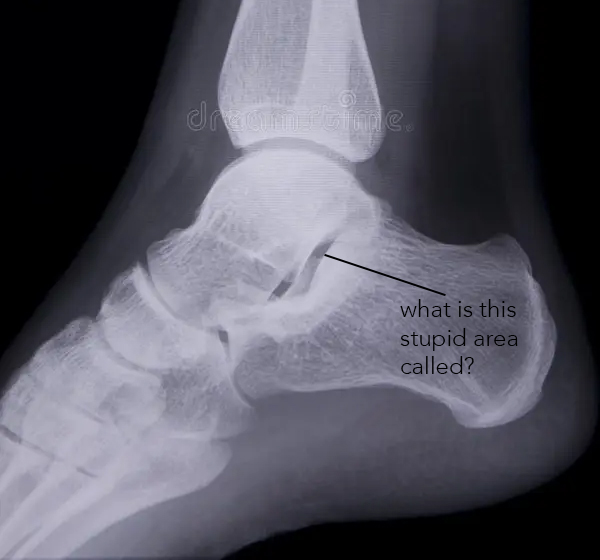 <p>what other joint space is open?</p>