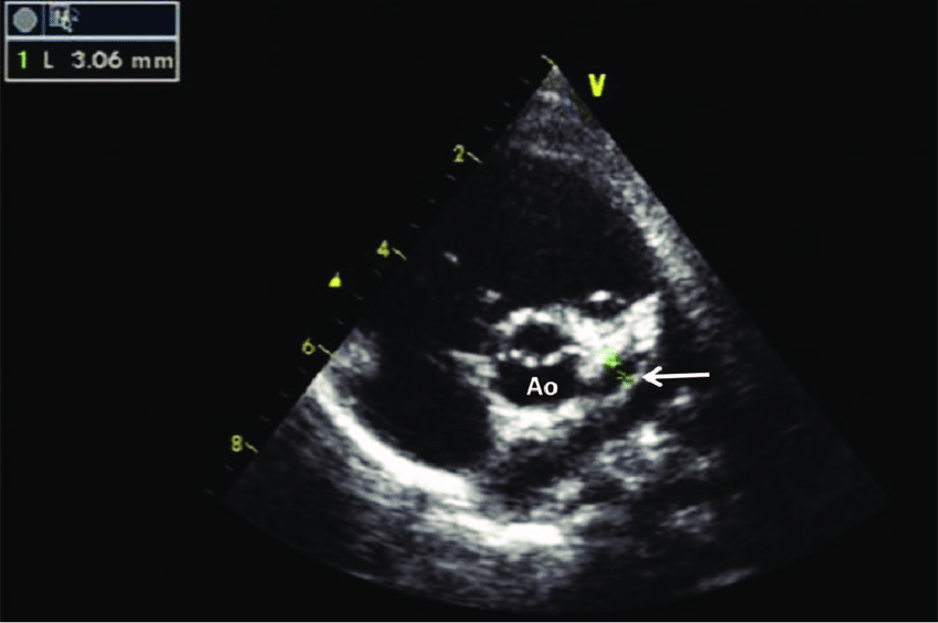 <p>What artery is seen in this image?</p>