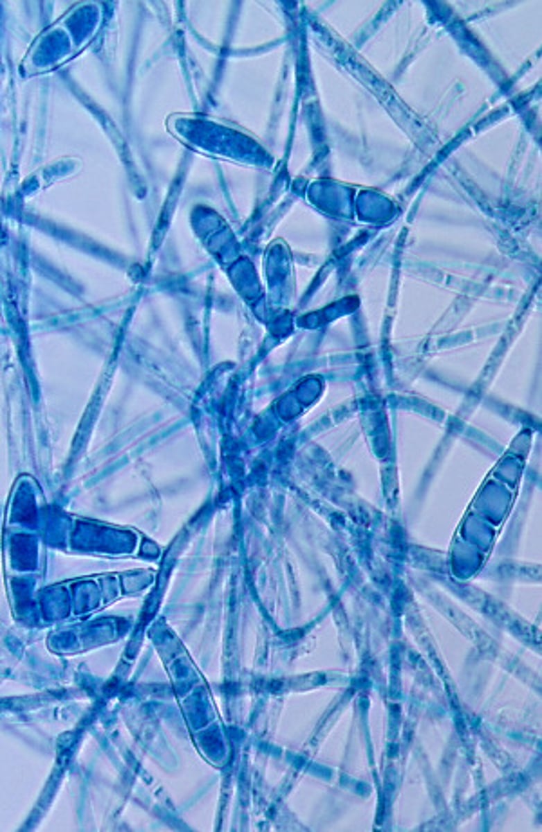 <p>Epidermophyton floccosum produces clusters of smooth, club-shaped macroconidia. The cell walls of Epidermophyton are thicker than those of the genus Trichophyton.</p>