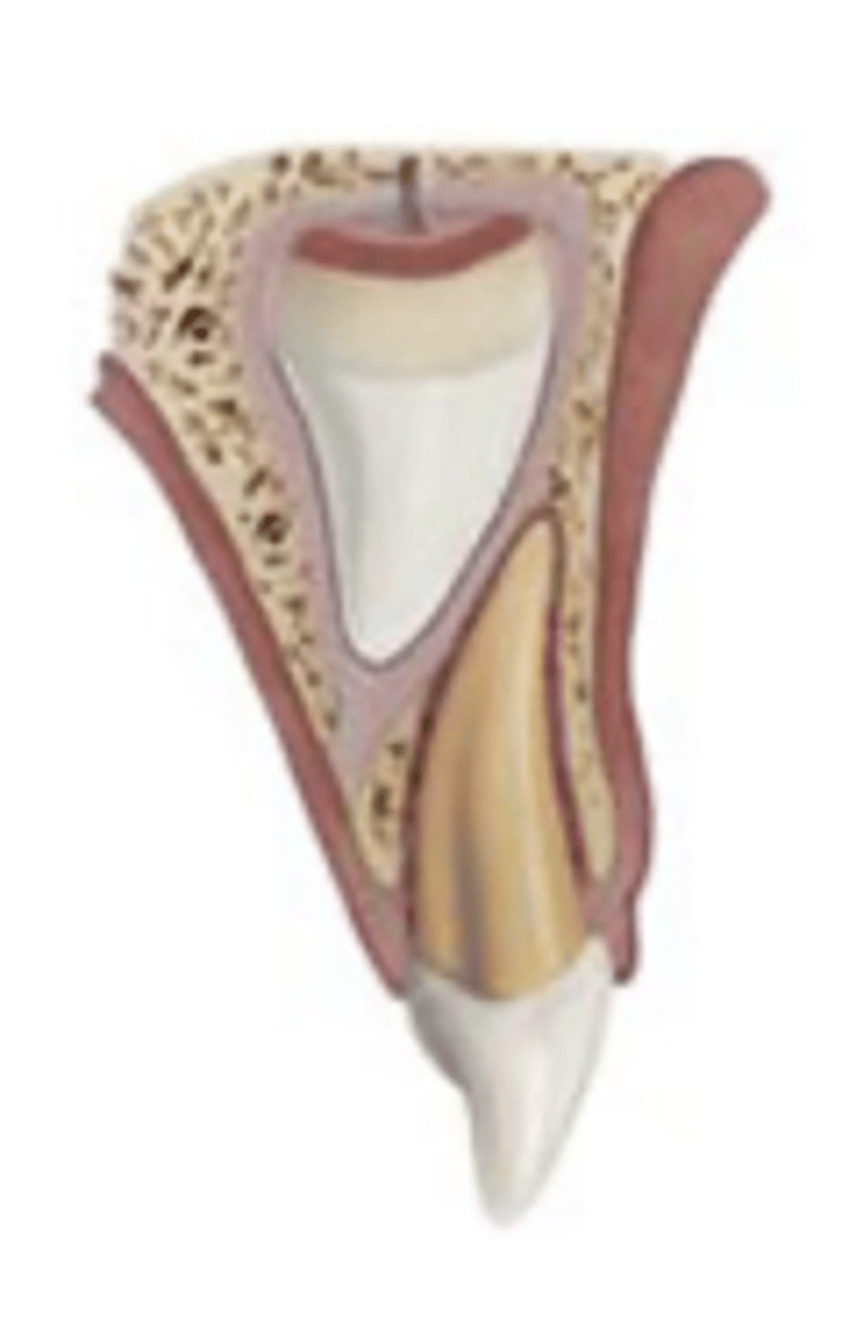 <p>c. Extrusive luxation</p>
