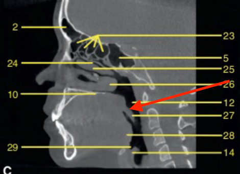 <p>identify the structure </p>