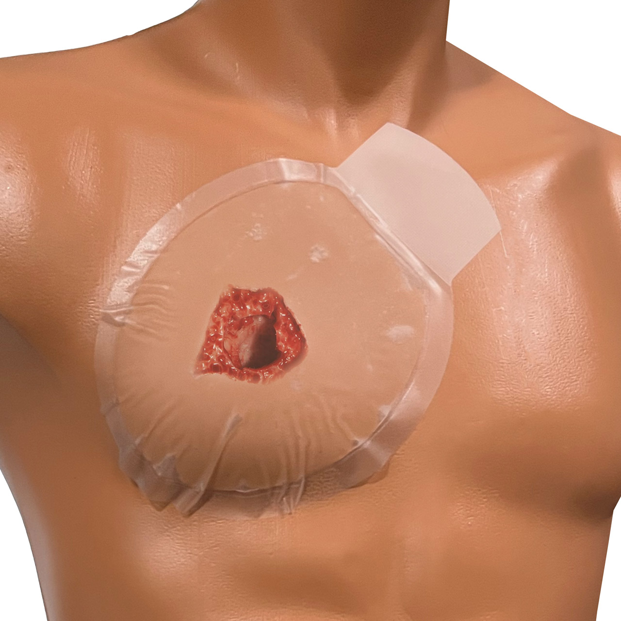 <ul><li><p><span><span>Air drawn in through hole</span></span></p></li><li><p><span><span>Wound to the chest</span></span></p></li><li><p><span><span>Sucking sound</span></span></p></li><li><p><span><span>Small air bubbles within wound</span></span></p></li><li><p><span><span>Patient may gasp for air</span></span></p></li></ul><p></p>