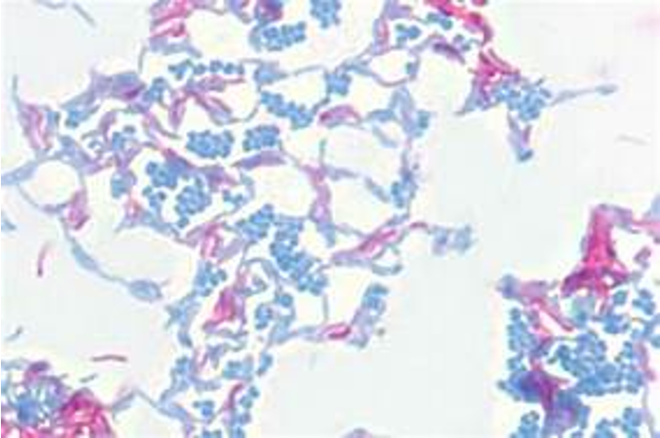 <p>Which cells are acid fast </p>