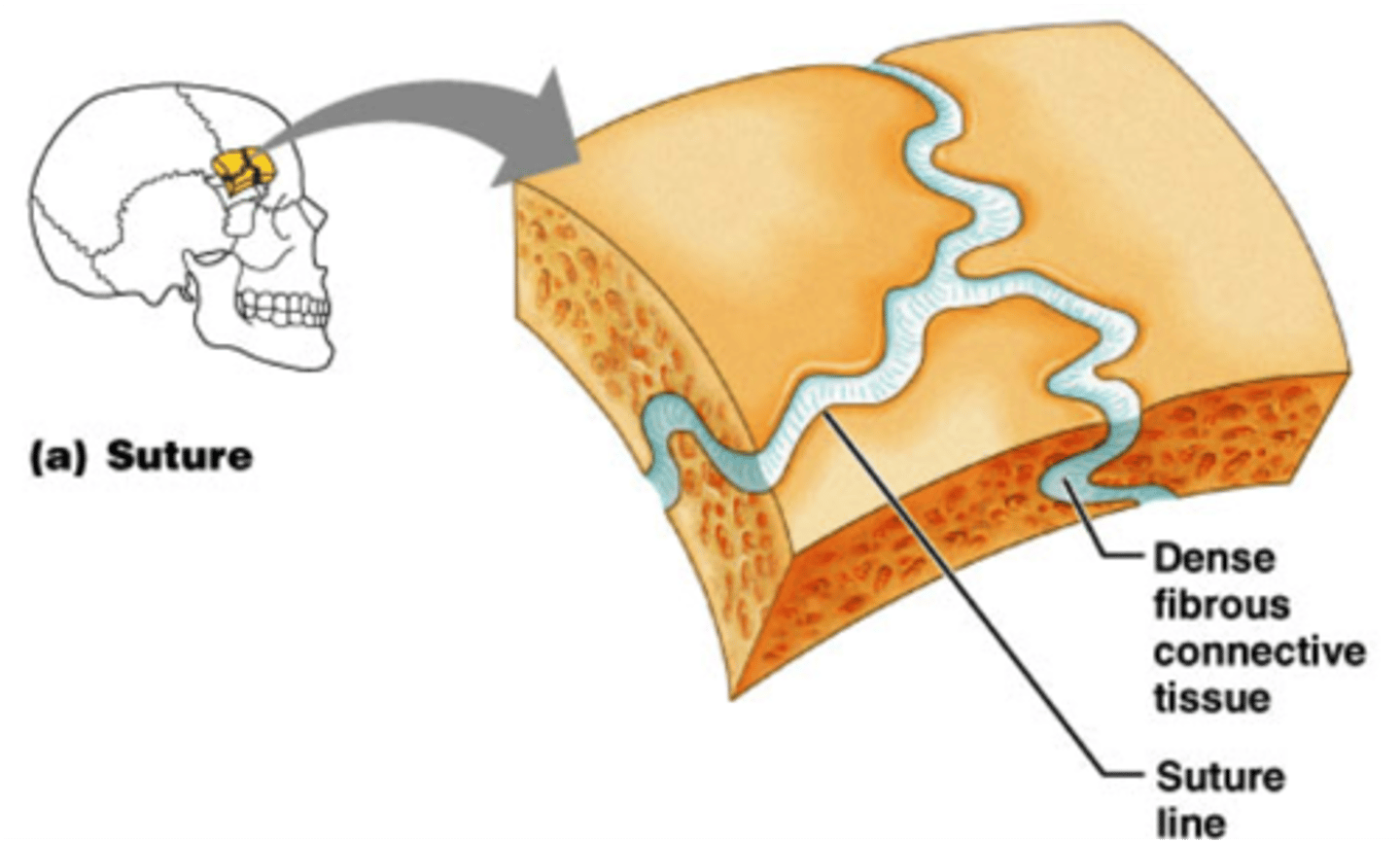 <p>sutures between skull bones that are joined by fibrous connective tissue and are IMMOVABLE</p>