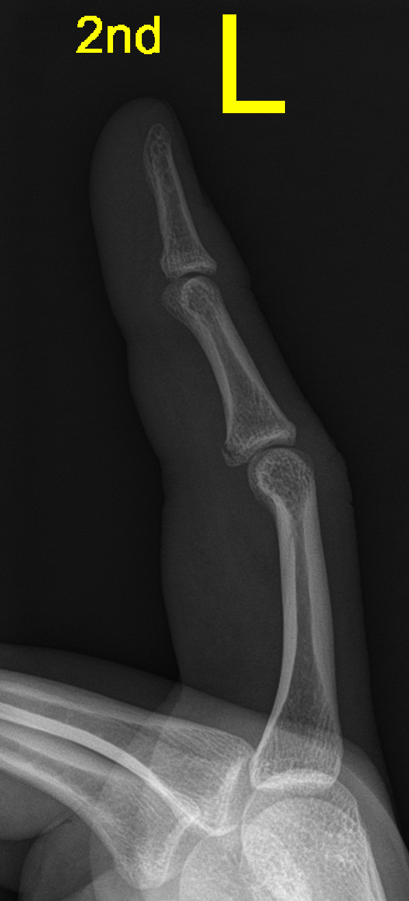 <p>Describe the abnormality demonstrated. </p>