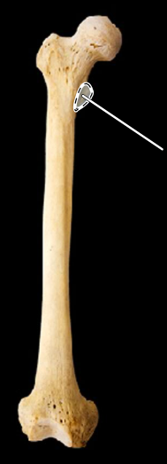 <p>Femur, anterior view, right side</p>