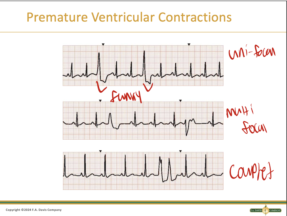 <p>They vary based on the type</p>