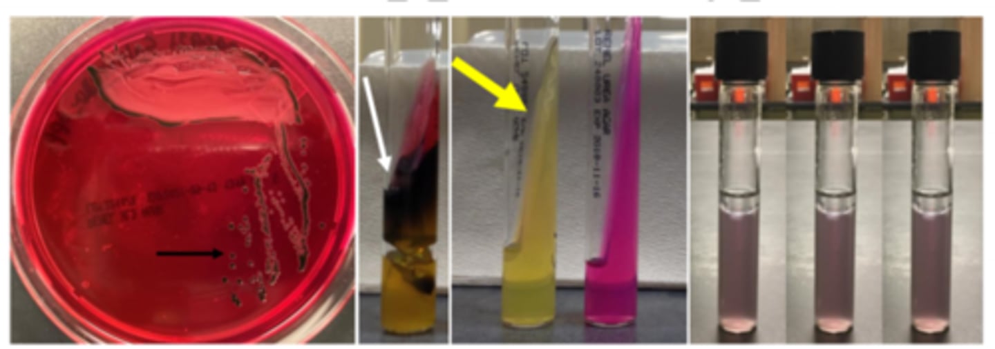 <p>-Non-lactose fermentation</p><p>-Growth on highly selective agar</p><p>-H2S-positive (black colonies)</p><p>-Urease-negative</p><p>-Phenylalanine-negative</p><p>-Can decarboxylate lysine, arginine, and ornithine </p><p>-Co #1 bacterial pathogen </p><p>-motile </p>