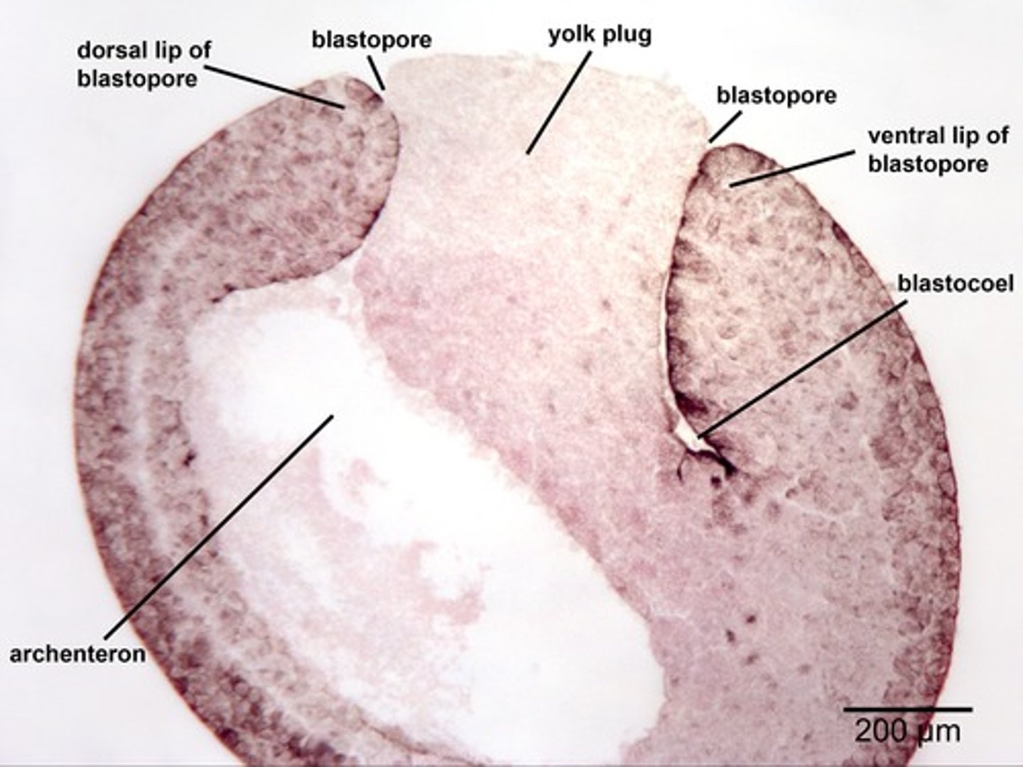 <p>yolk plug</p>