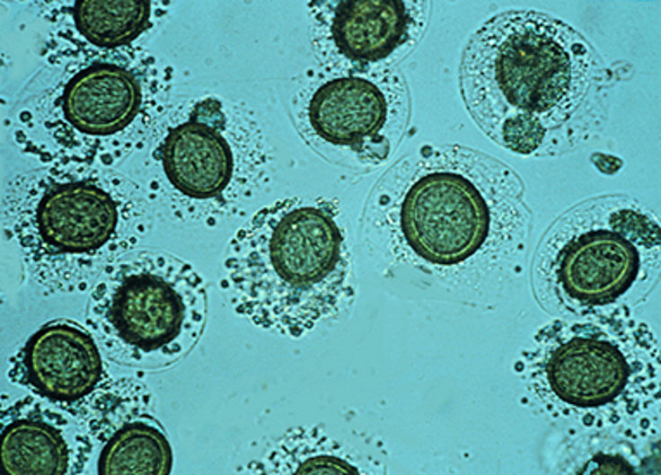 Host: cats
Intermediate host: rats, mice, voles, and humans
Location: small intestine
Transmission: ingestion of infective intermediate host
Diagnosis: fecal float or using enema to collect feces
Treatment: praziquantel
Zoonotic?: SERIOUS POTENTIAL
REPORTABLE TO WHO AND CDC
Common name: multilocular hydatid tapeworm