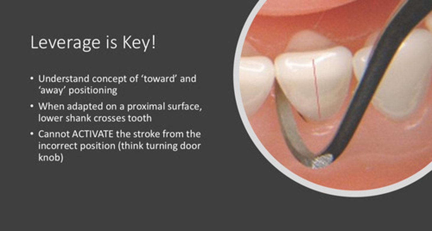 <p>1) understand the concept of "toward" and "away" positioning</p><p>2) when adapted on a proximal surface, the lower shank crosses the tooth</p><p>3) cannot activate the correct stroke from the incorrect position! (think turning door knob)</p>