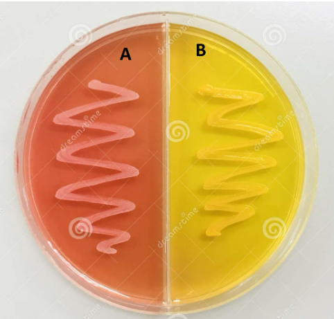 <p>The results in this image represent two different bacterial species inoculated on an MSA plate. Which, if any, organism(s) ferment mannitol?</p>