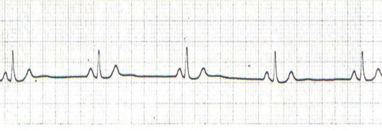 <p>what is this?</p>