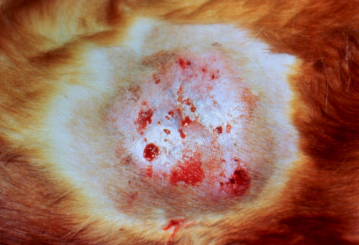 <p><span>Zygomycosis</span></p>