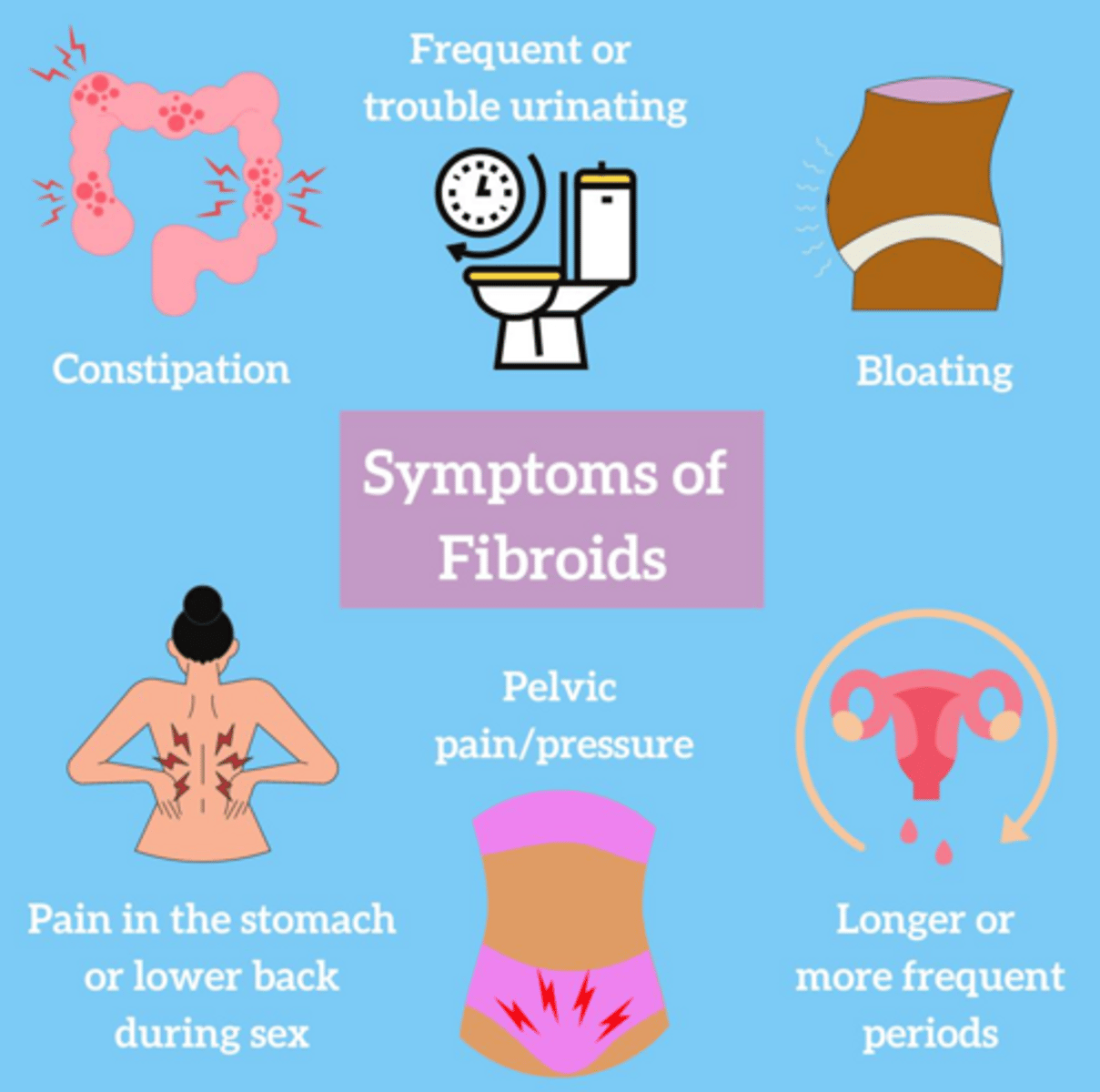 <p>Pelvic pain/pressure, urinary frequency, urgency or retention, back pain, constipation, and dyspareunia.</p>