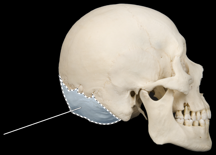 <p>Name this bone.</p><p>(Skull, lateral view).</p>