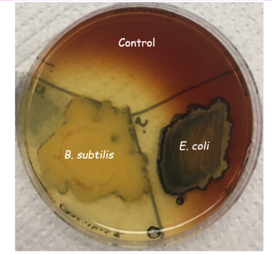 <p><span>Starch Agar – Results #1</span></p>