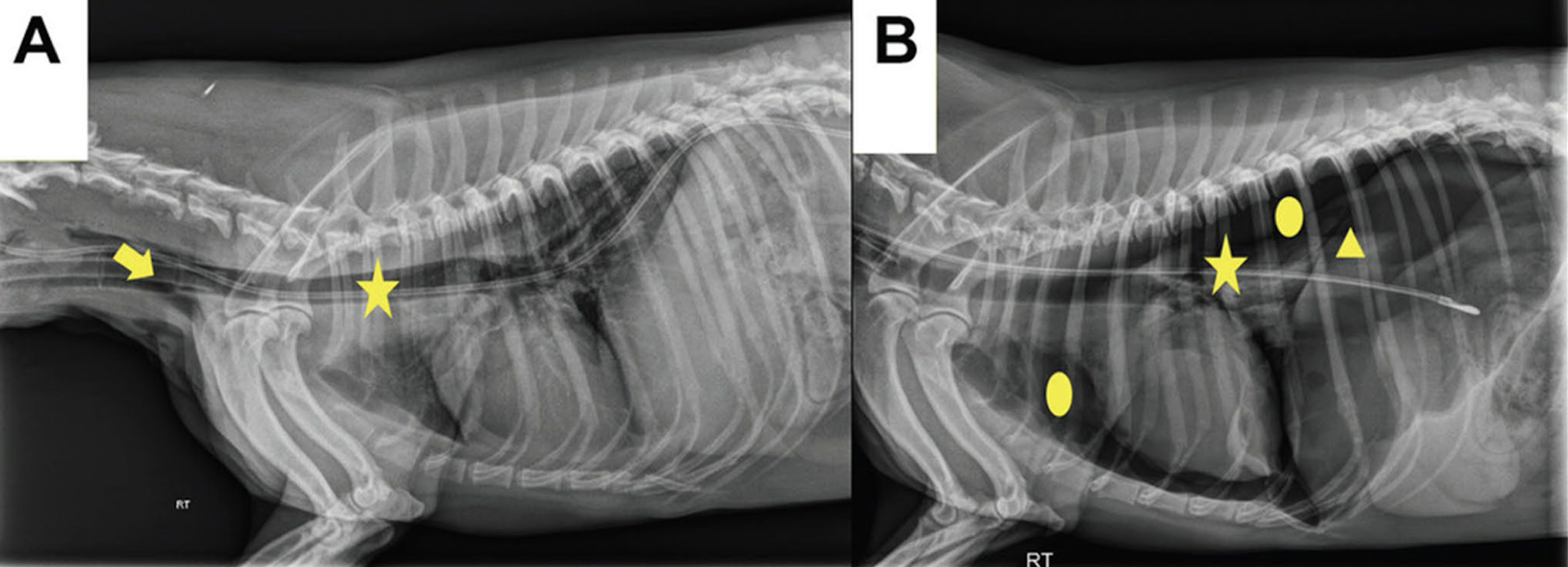<p>What is wrong with the placement of this NG tube in image A? What is going on in image B?</p>