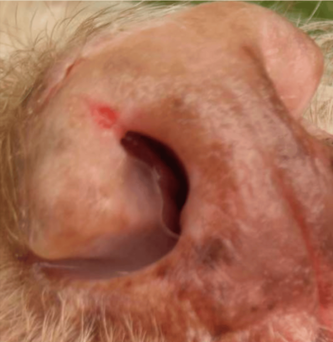 <p>¿lesión?</p><p>¿primaria o secundaria?</p>