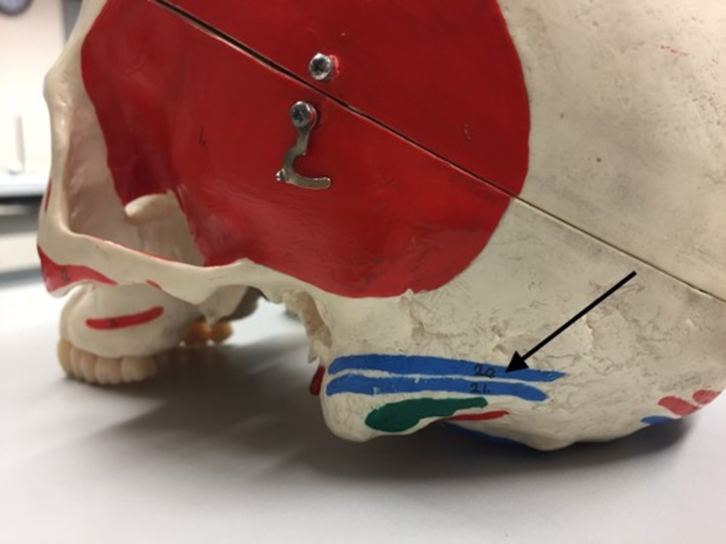 <p>20</p><p>I: Mastoid process</p>