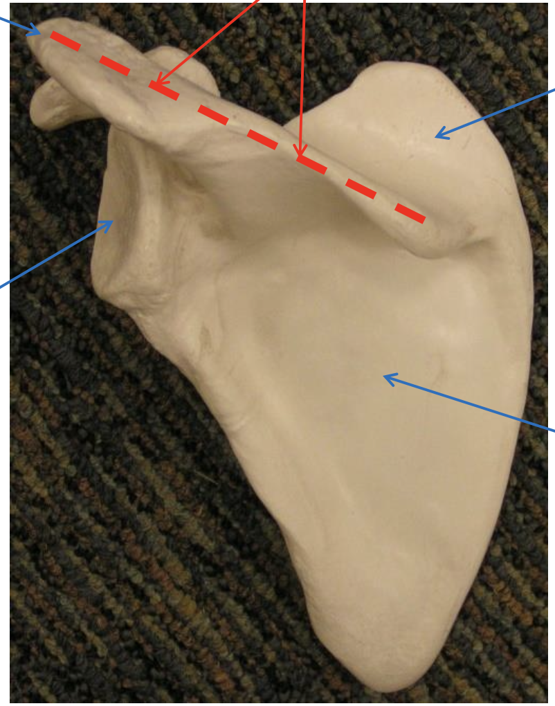<p>Name the bone.</p>