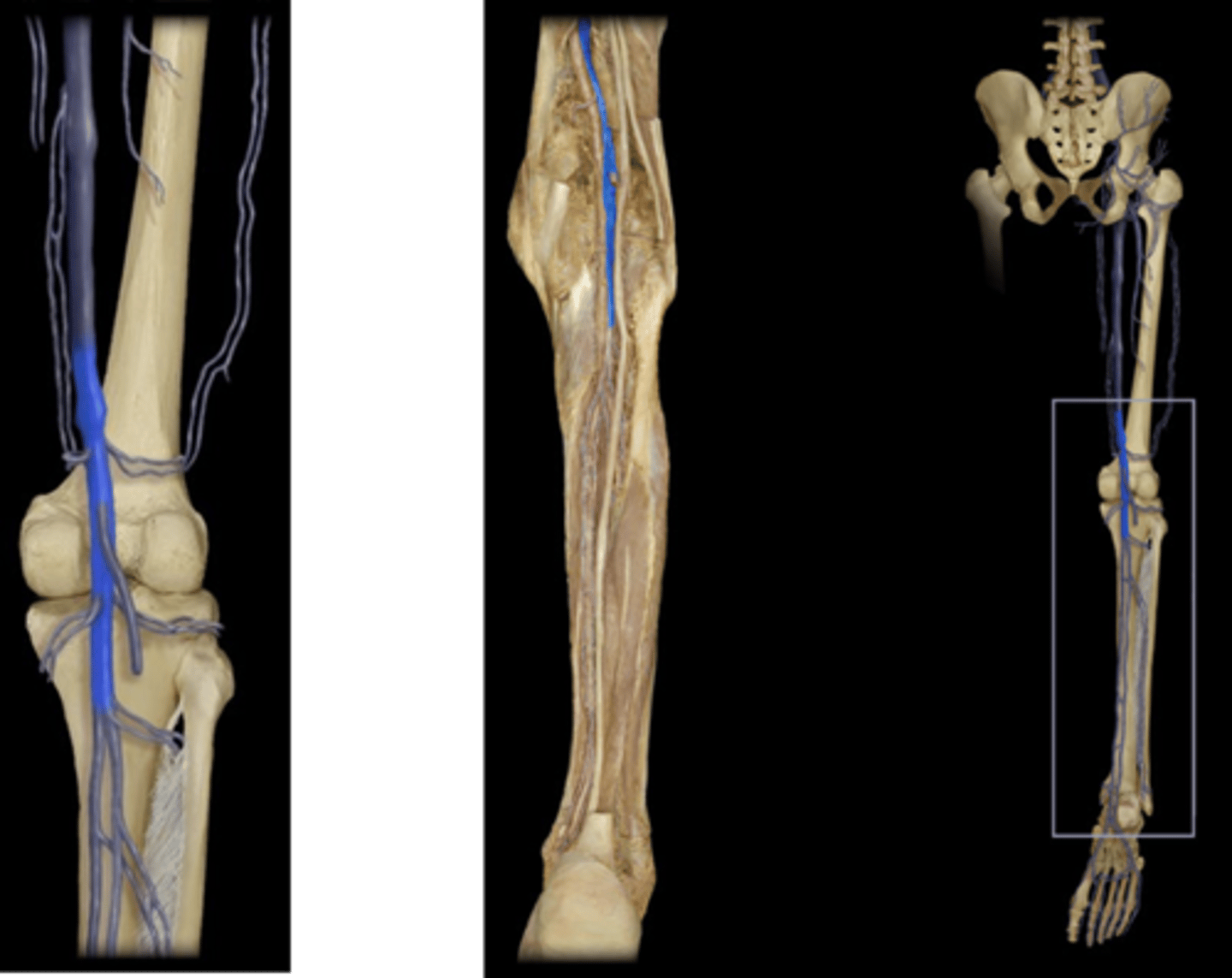 <p>Name this vessel.</p>