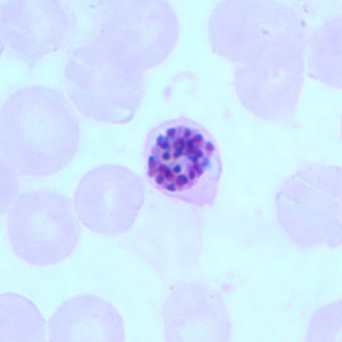 <p>flower-like?, lots of dots; won't usually see in thin blood film bc sequestered</p>
