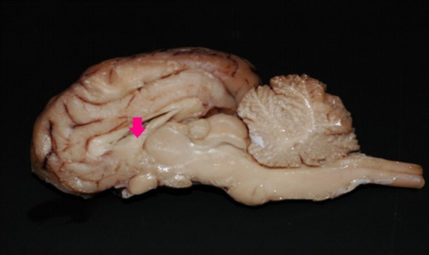 <p>Identify the structure.</p>