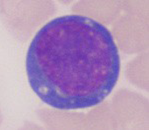 <ul><li><p>increased basophilia in cytoplasm</p></li><li><p>more abundant cytoplasm than normal</p></li><li><p>kidney bean shaped nucleus</p></li><li><p>caused by antigenic stimulation</p><ul><li><p>vaccines or infection </p></li></ul></li></ul><p></p>