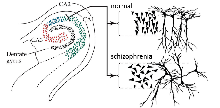<p>Environmental exposures + genetic vulnerability<br>Illness occurs if a threshold is exceeded<br>Factors up-regulate and down-regulate gene function<br>Epigenetics: People with the same genome can have different outcomes.</p><p>Brain defects in schizophrenia apparently stem from environmental exposures during pregnancy</p><p>Pyramidal neurons in hippocampus are disorganized in schizophrenia.<br>Hippocampus and amygdala are smaller in some schizophrenics.</p>