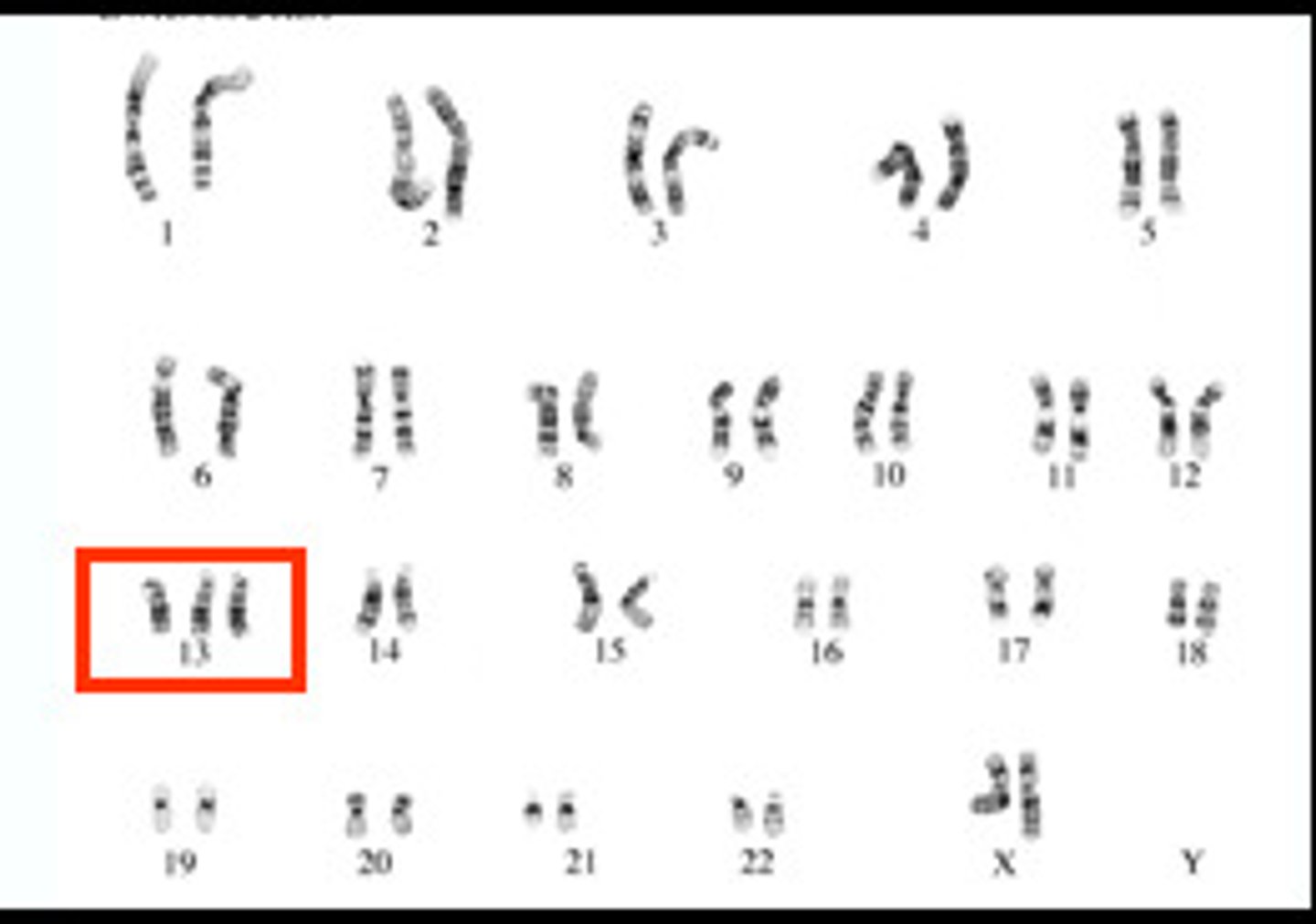 <p>a condition in which an extra copy of a chromosome is present in the cell nuclei, causing developmental abnormalities.</p>