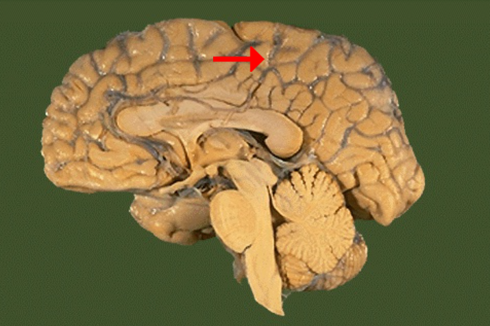 <p>Label this brain part</p>
