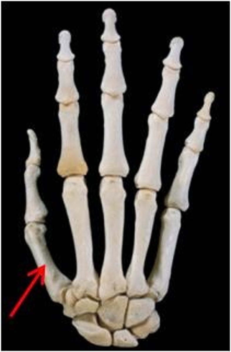 <p>ID bone</p>