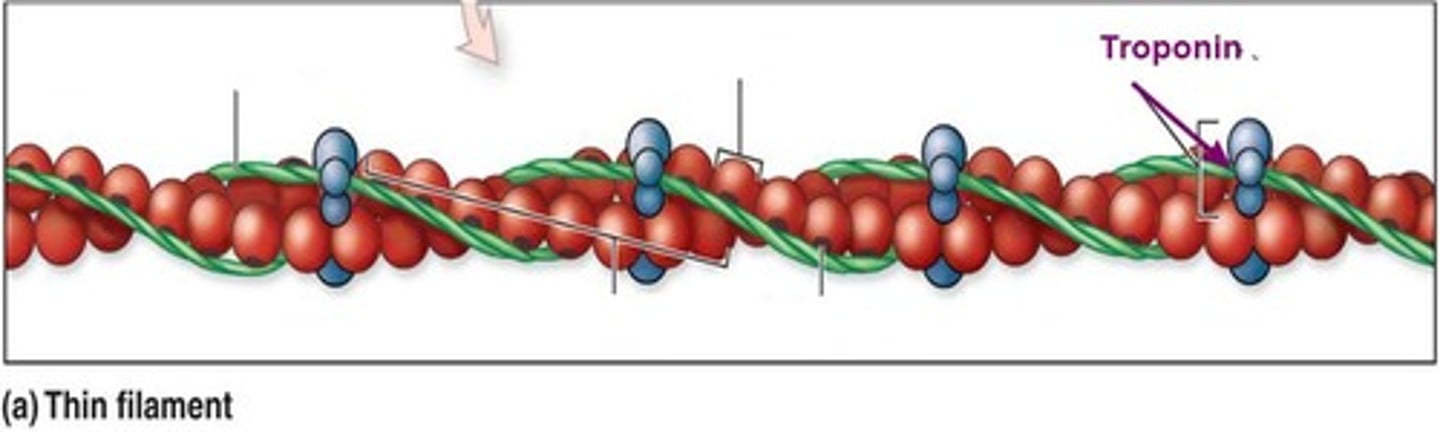 <p>Troponin</p>