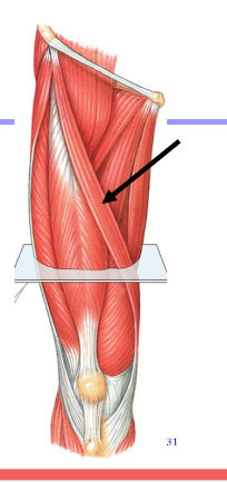 <p>Origin: Anterior superior iliac spine</p><p>Insertion: Medial margin of tibial tuberosity</p><p>Action: Flexes both femur and tibia</p>