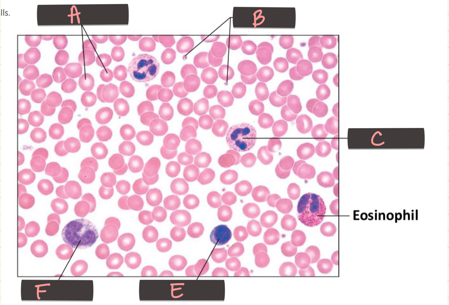<p>Eosinophil</p>