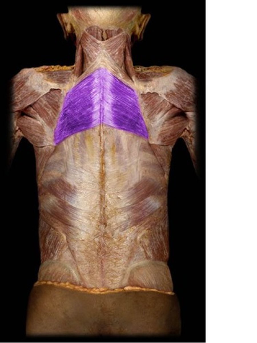 <p>What is this muscle, and what is its action, Proximal &amp; Distal insertions?</p>