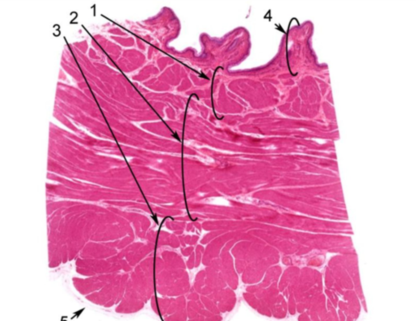 <p>Identify the layer of the bladder at 4</p>