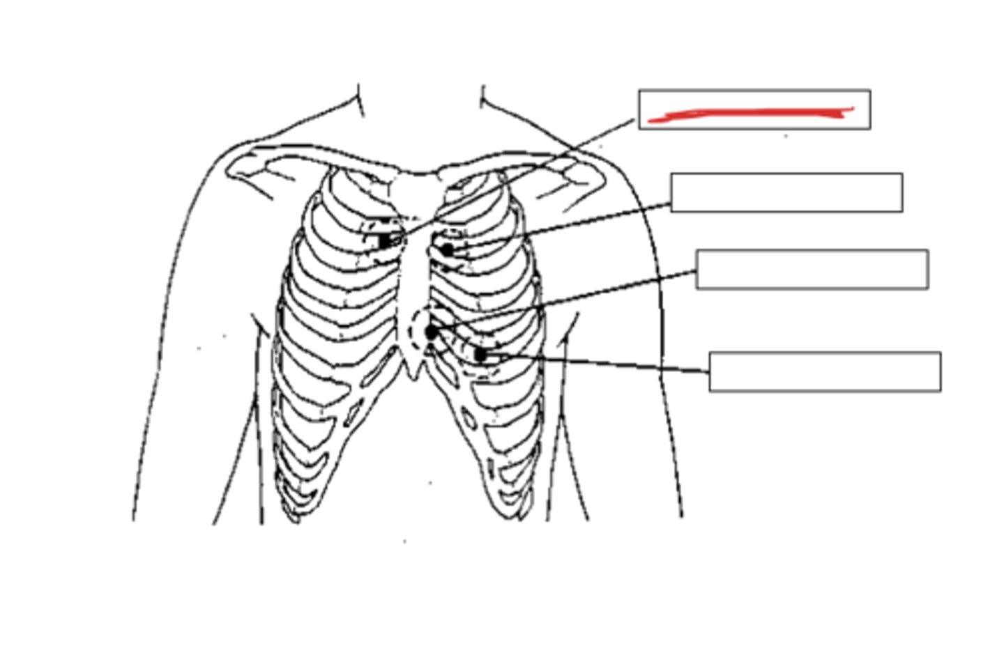 <p>at the second intercostal space (between ribs 2 &amp; 3) on the right sternal border</p>