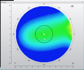<p>what does this elevation map show? </p>