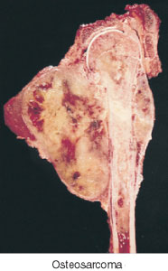 <p><span><span>Identify the pathology definition for the following illustration.</span></span><br></p>