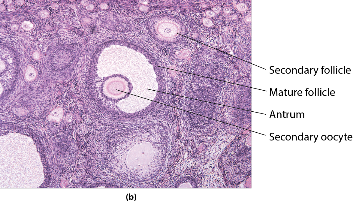 <p>What is the organ pictured?</p>