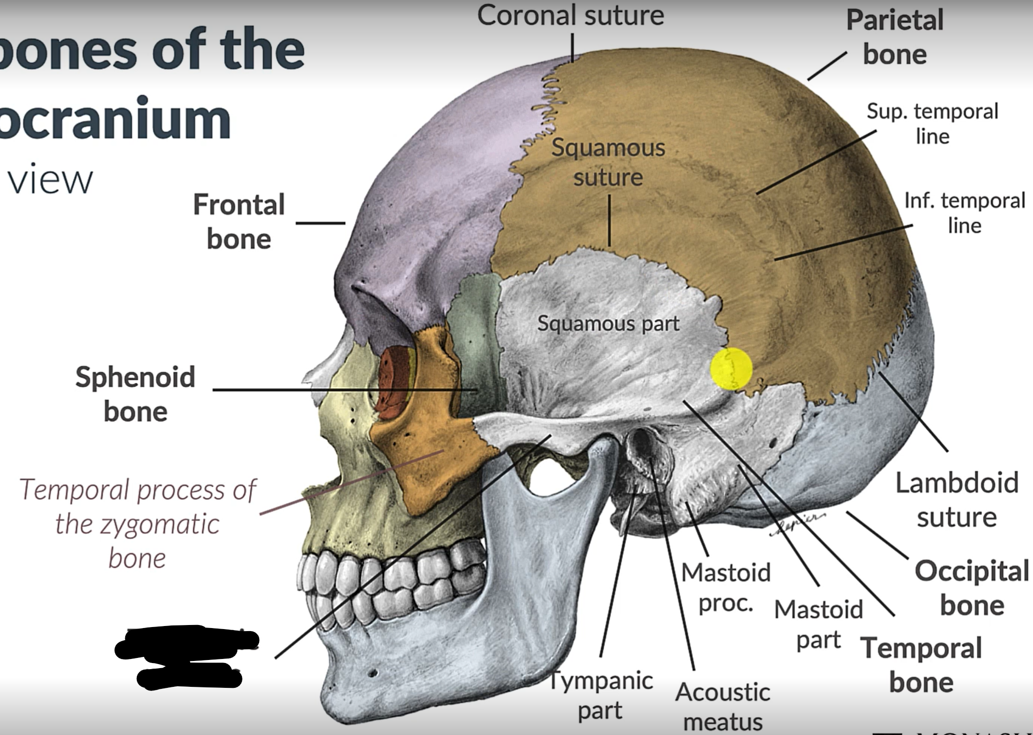 term image