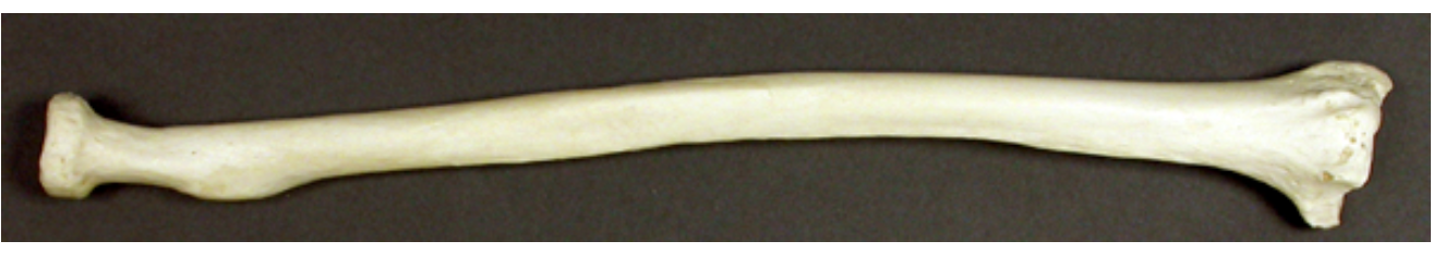 <p>The bone in the photo is radius. What structural type of amphiarthrotic joint is formed between the radius and ulna where the interosseous membrane is present?’</p><p></p><p>A. syndesmosis</p><p>B. gomphosis</p><p>C. synchondrosis</p><p>D. symphysis</p>