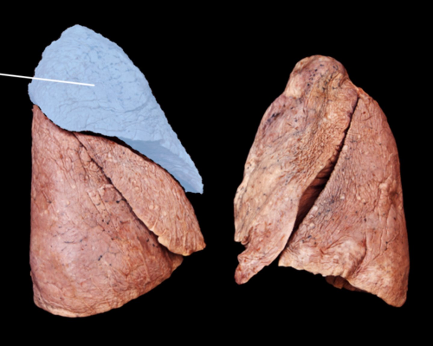 <p>top love of the three lobes</p><ul><li><p>structure</p></li></ul><p></p>