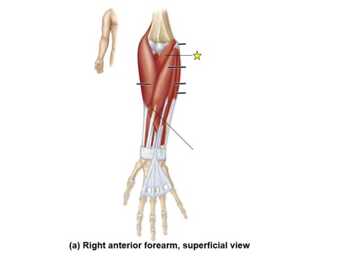 <p>identify the muscle</p>