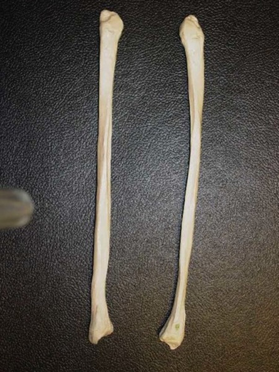 <p>Smaller distal leg bone</p>