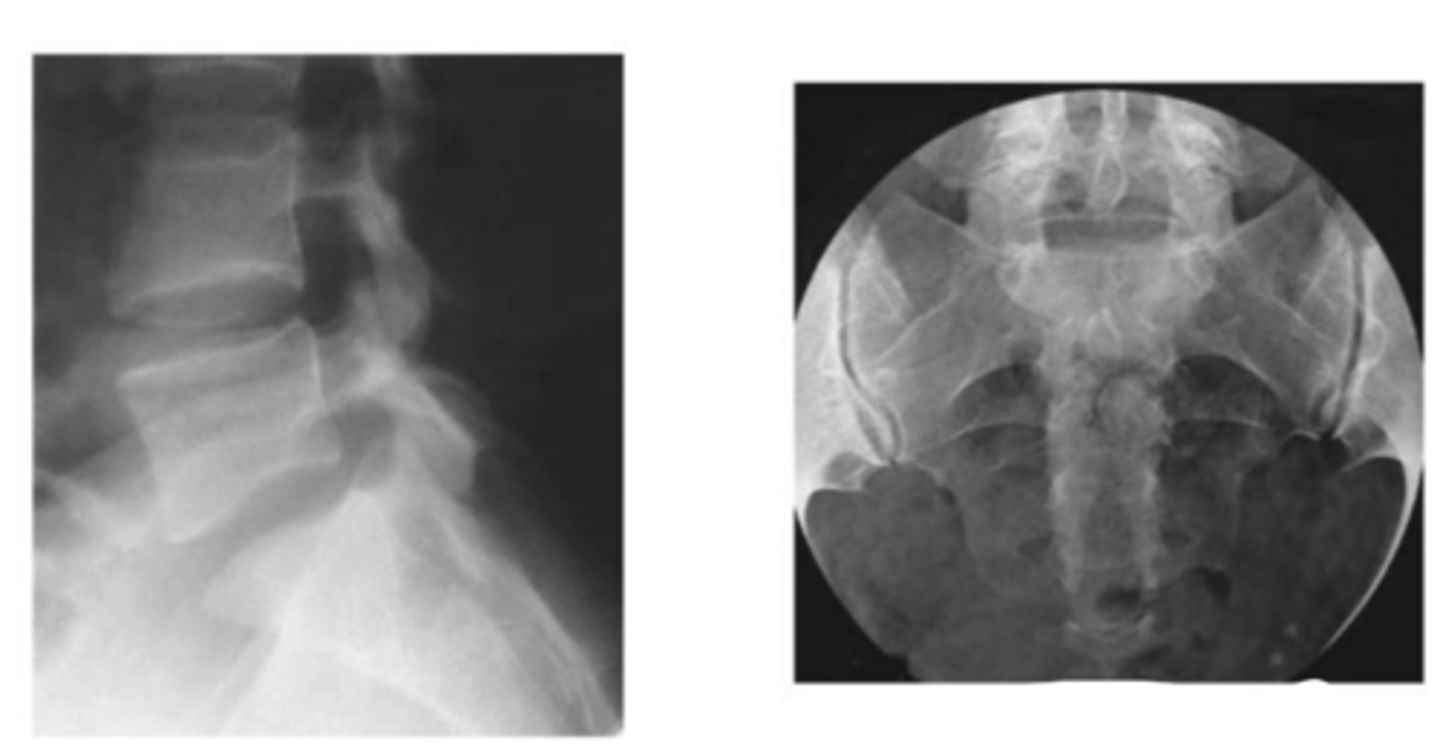 <p>what joints can we see in these radiographs</p>